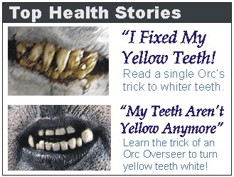 Orc Teeth